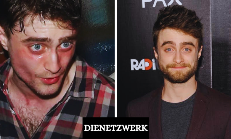 Daniel Radcliffe Krankheit