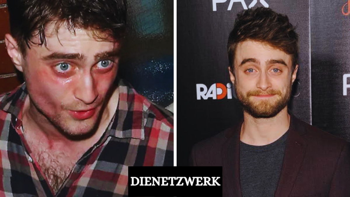 Daniel Radcliffe Krankheit